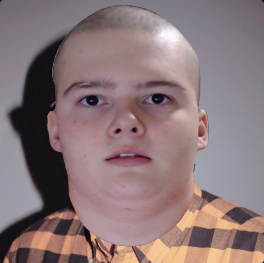 CHEESEDADDY — shine bright (BALD DADDY) cover artwork