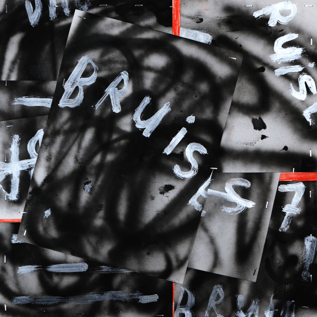 NGHTMRE & Grabbitz — Bruises cover artwork