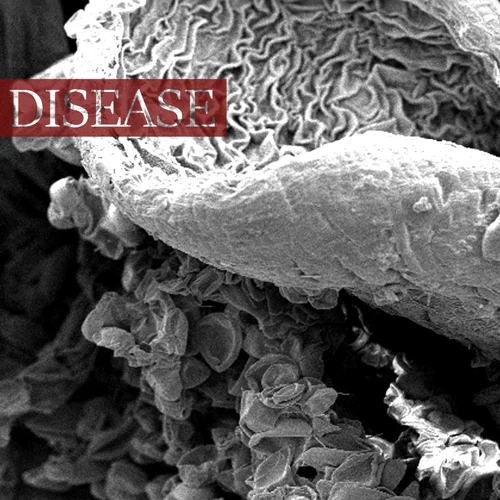 ΛΛ4Я4ZΛΛ Disease cover artwork