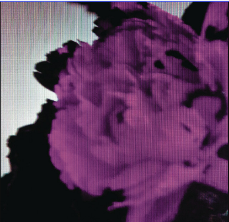 John Legend & Tiësto — All of Me (Tiësto&#039;s Birthday Treatment Remix) cover artwork